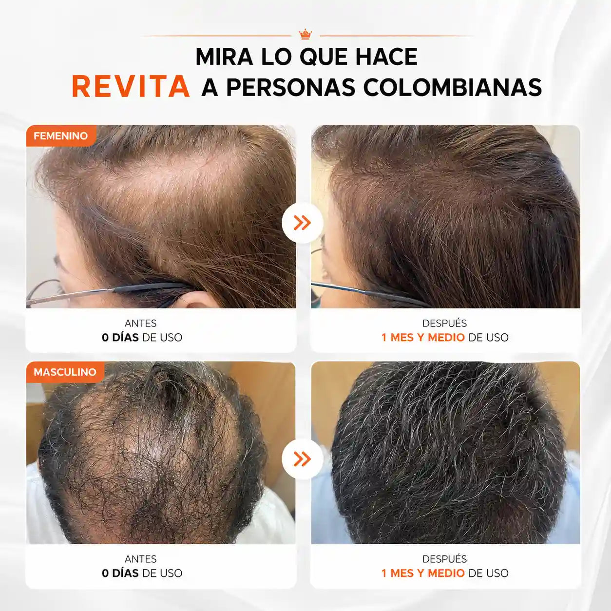 Revita: Crece tu cabello y estimula los foliculos pilosos