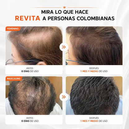 Revita: Crece tu cabello y estimula los foliculos pilosos